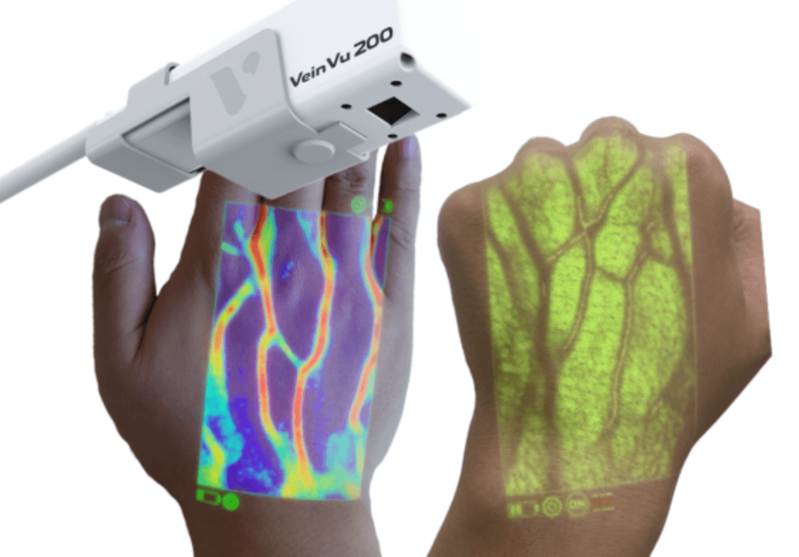 VeinVu 200 Pro vein scanner projecting a vein map onto a patient's hand