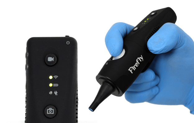 Firefly digital video otoscope